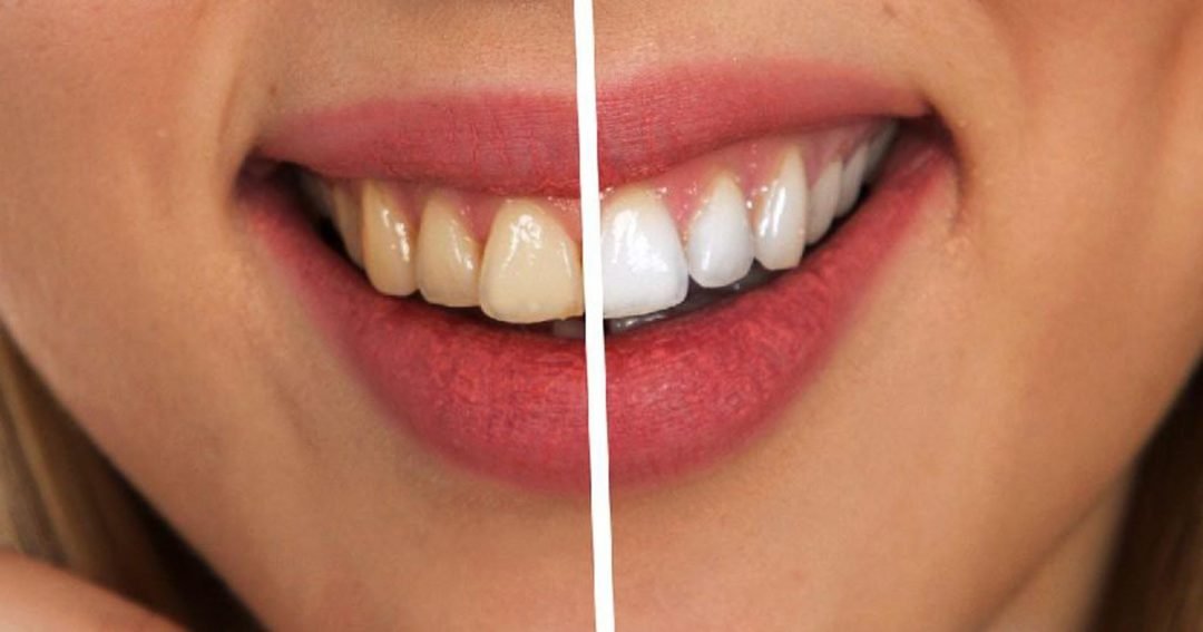 ESTÉTICA DENTAL